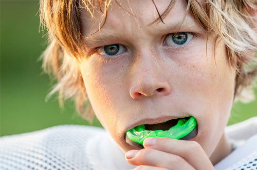 Get Your Kid a Custom Mouthguard for Spring Sports & More
